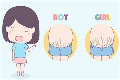 妊娠线看生男生女超准的方法 宝妈自娱自乐也是可以的 - 妈妈育儿网